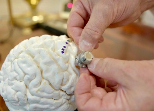 Cortimo-3d-printed-brain-research-feature