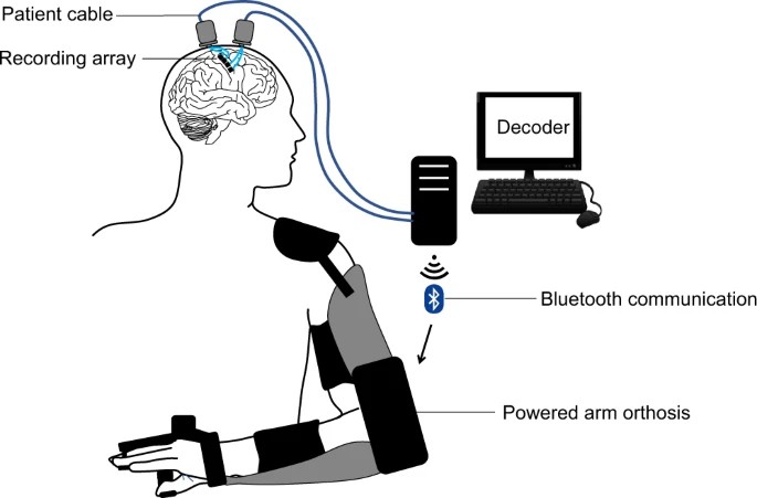 The overall device comprises two Multiports, each with two 8 × 8 microelectrode arrays, patient cables linked to external amplifiers, a decoding computer and a wearable, powered arm orthosis.